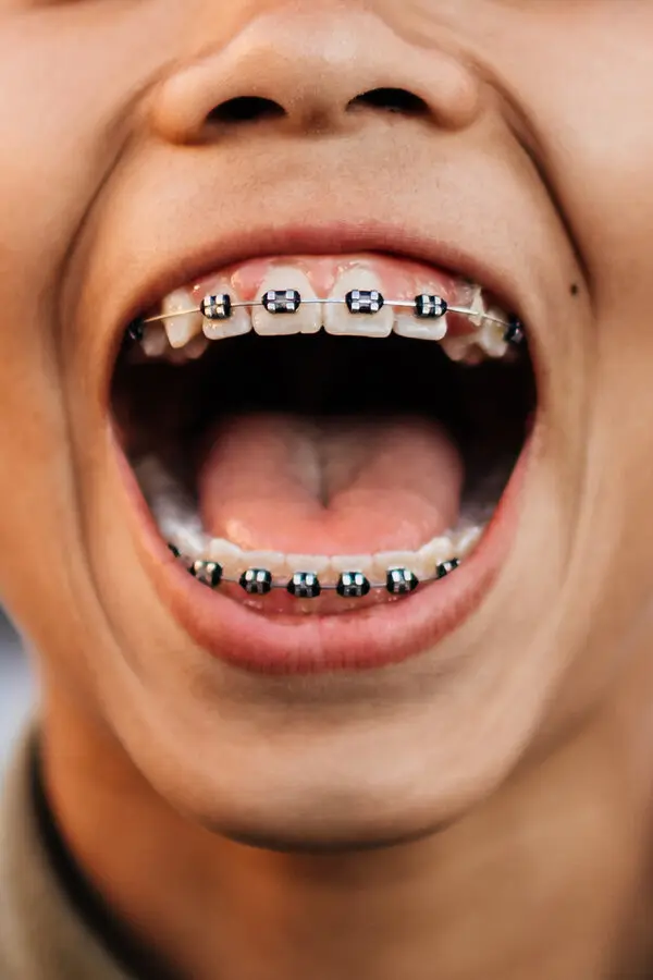 07METAL-MOUTH-jzct-articleLarge