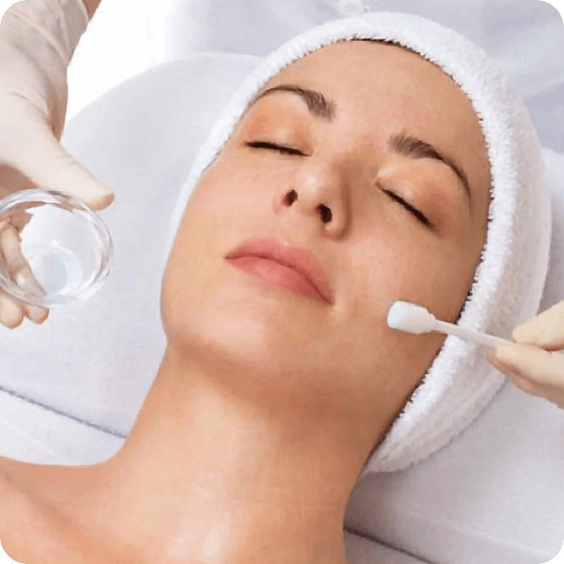 chemical-peels