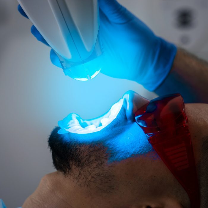 dentist-performs-uv-teeth-whitening-patient-uses-2026-02-28-23-22-41-utc-700x700