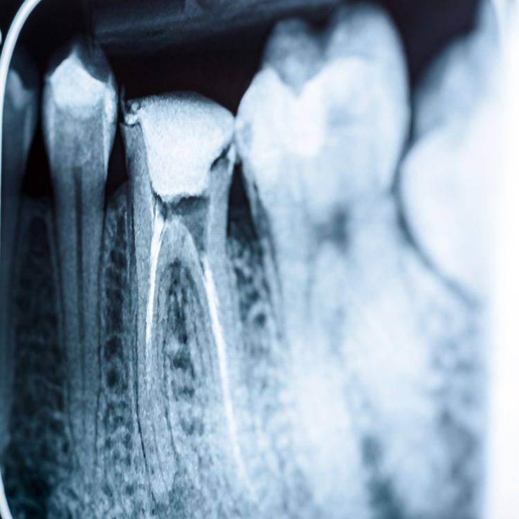 teeth-xray-tonbridge-750x750