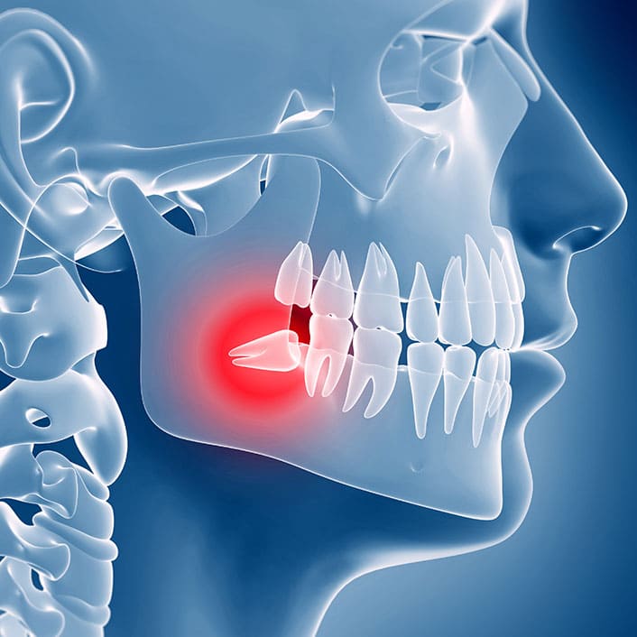 tmj-treatment-lg